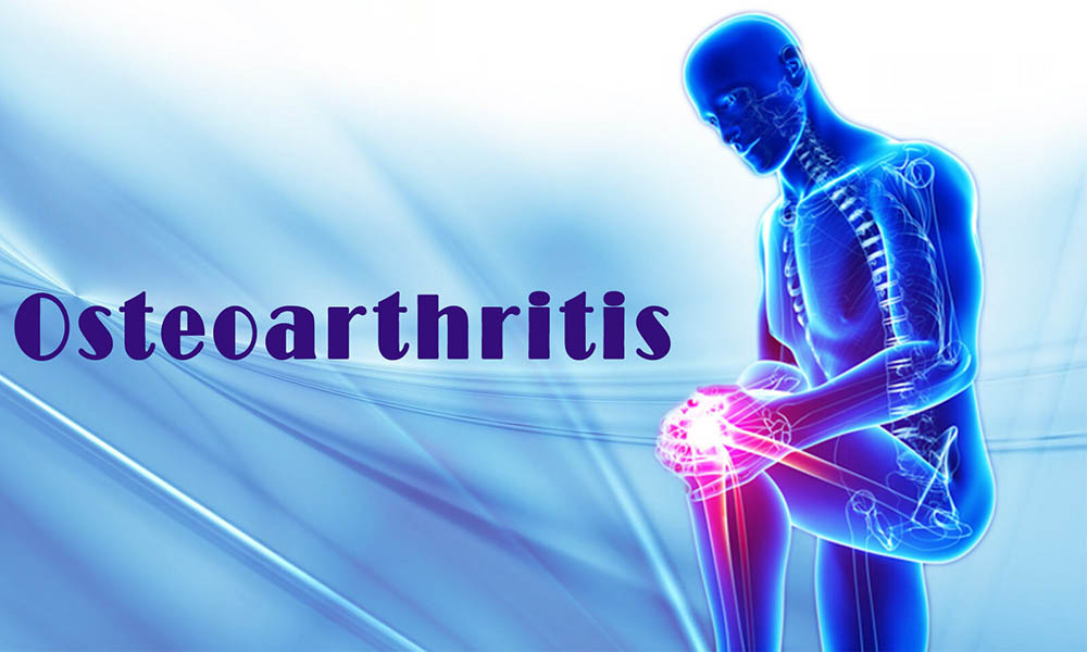 Study: Turmeric’s Curcumin Effectively Reduces Pain in Osteoarthritis Patients